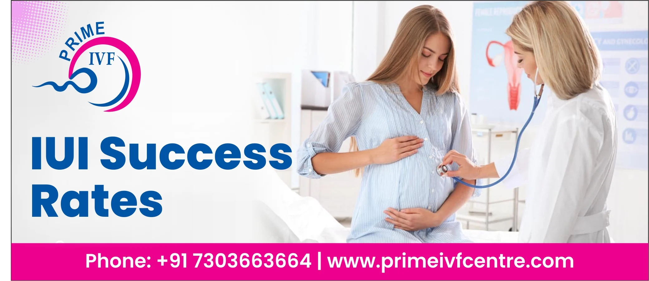 IUI Success Rates- आईयूआई की सफलता दर किन किन कारकों पर निर्भर करता हैं