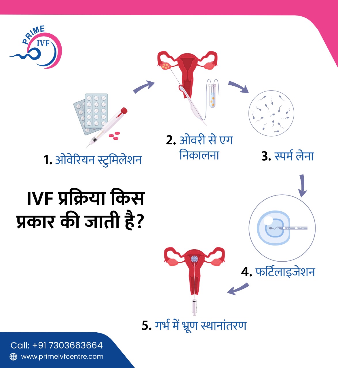 ivf process diagram