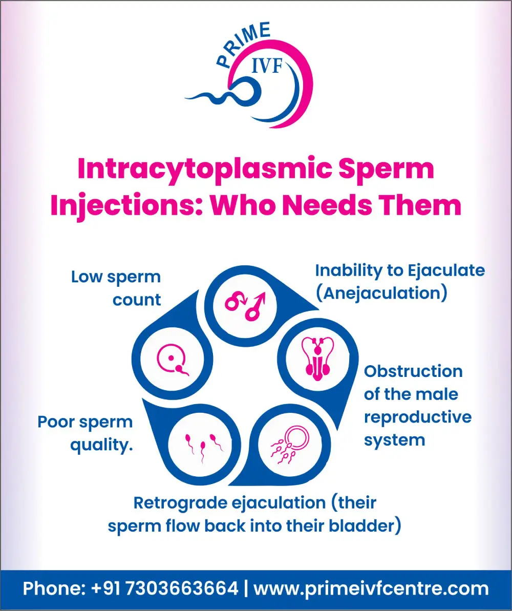 intracytoplasmic-sperm-injection